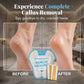 Exfoliating Foot Peel Mask for Callus Removal